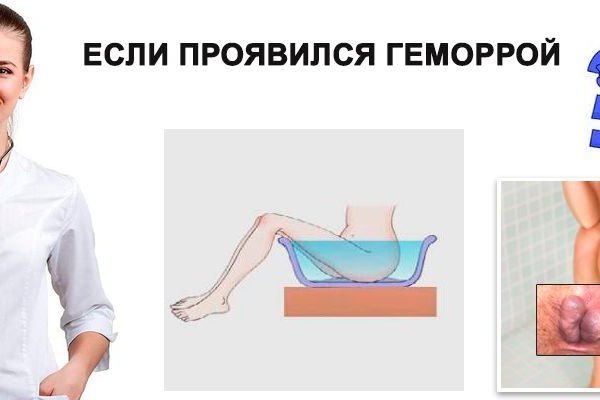 Кракен 20 at